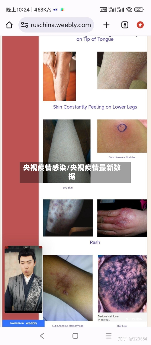 央视疫情感染/央视疫情最新数据-第3张图片