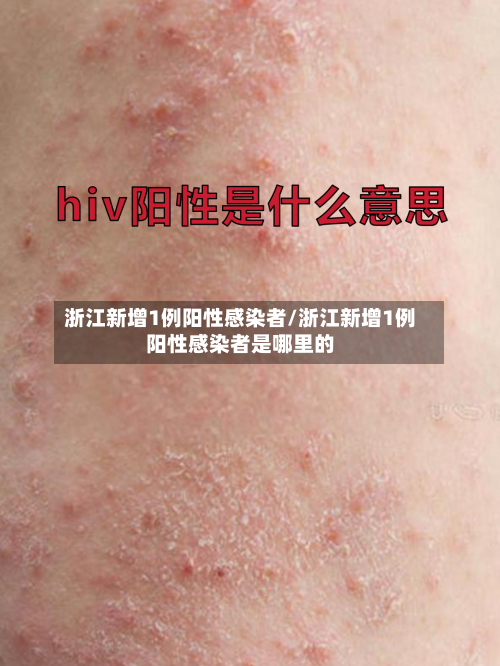 浙江新增1例阳性感染者/浙江新增1例阳性感染者是哪里的-第2张图片