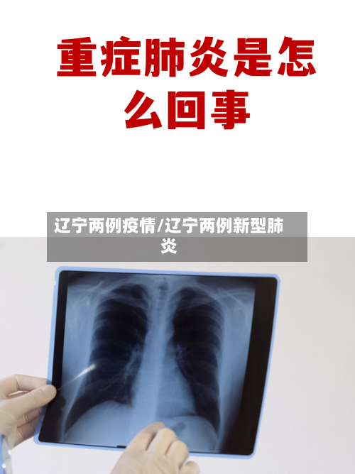 辽宁两例疫情/辽宁两例新型肺炎-第2张图片