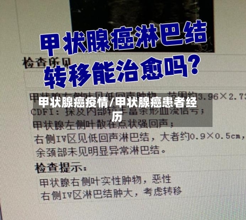 甲状腺癌疫情/甲状腺癌患者经历-第2张图片