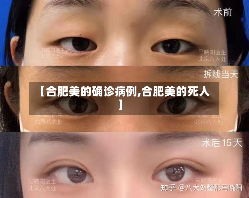 【合肥美的确诊病例,合肥美的死人】-第2张图片