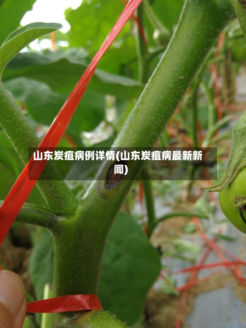山东炭疽病例详情(山东炭疽病最新新闻)