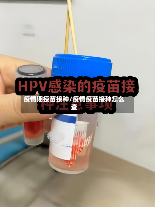 疫情期疫苗接种/疫情疫苗接种怎么查-第2张图片