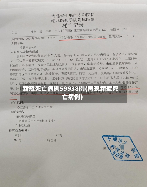 新冠死亡病例59938例(再现新冠死亡病例)