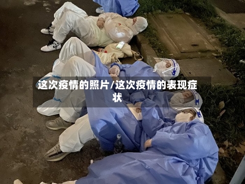 这次疫情的照片/这次疫情的表现症状