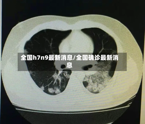 全国h7n9最新消息/全国确诊最新消息-第2张图片