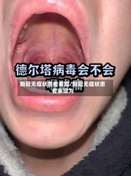 新冠无症状患者表现/新冠无症状患者表现为