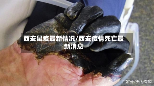 西安鼠疫最新情况/西安疫情死亡最新消息