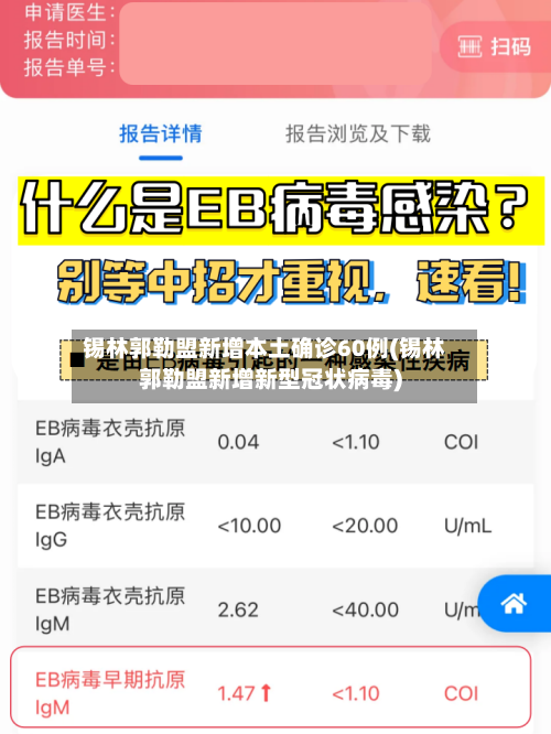 锡林郭勒盟新增本土确诊60例(锡林郭勒盟新增新型冠状病毒)