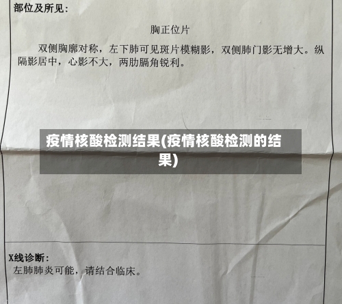疫情核酸检测结果(疫情核酸检测的结果)-第2张图片